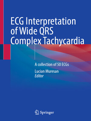 cover image of ECG Interpretation of Wide QRS Complex Tachycardia